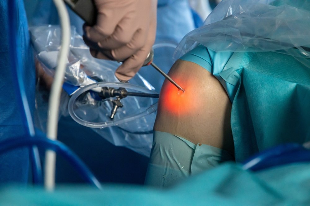 Knee,Arthroscopy,In,An,Orthopedic,Clinic
